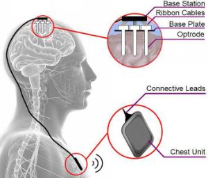 Illustration of the CANDO project implant system.